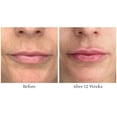 thumbnail image 3 of Tratamiento labial City Beauty City Lips Night Oil Antiedad, 3 of 8