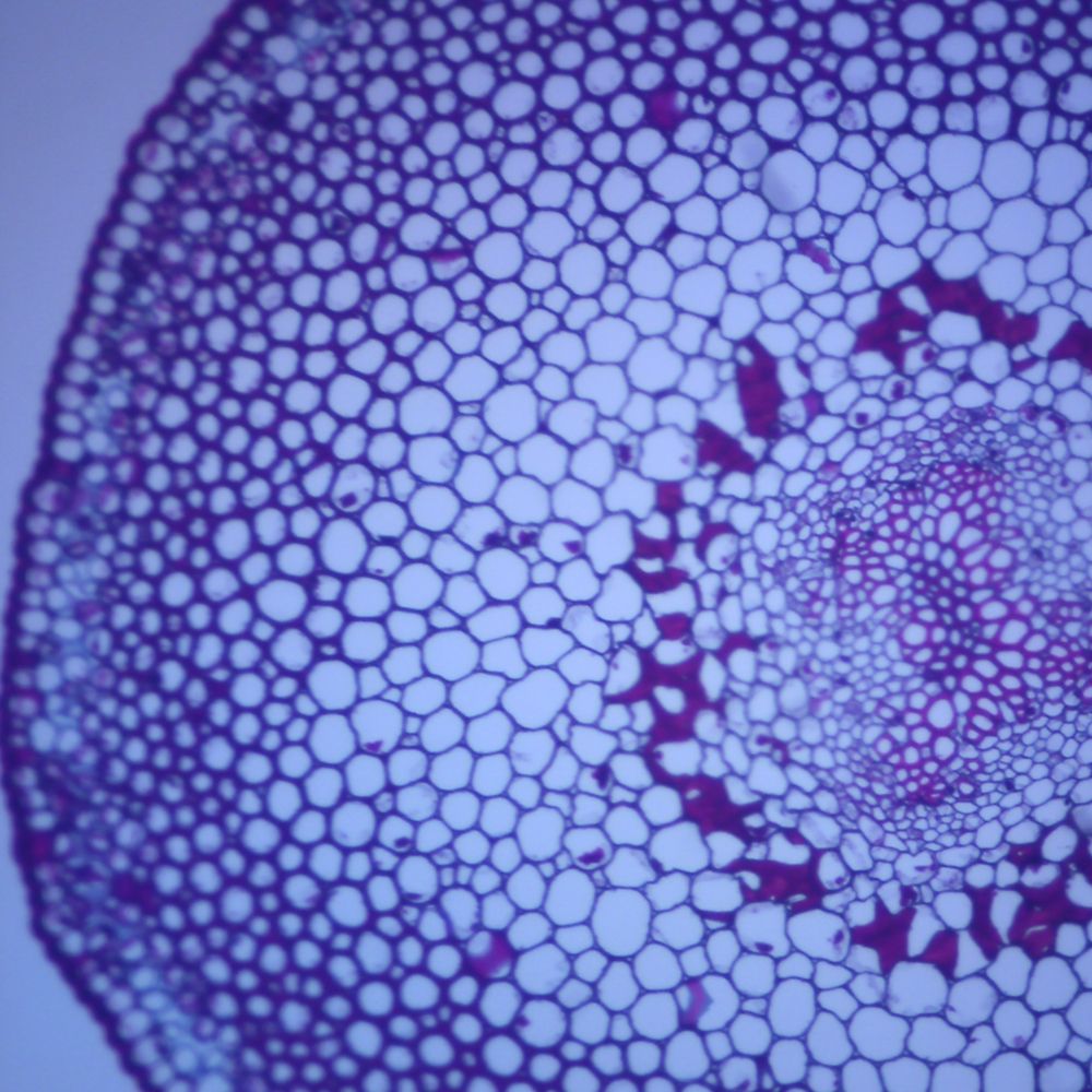 Psilotum Aerial Stem (Whisk Fern), C.S., 12 M Microscope Slide