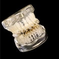 thumbnail image 5 of Fashionable Star Patterning Tooth Grills for Party Wear Easy Installation Upper and Lower Set Suitable for Hip Hop Fan, 5 of 8