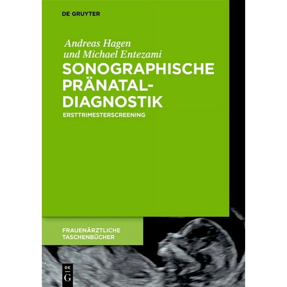 FrauenÃ¤rztliche TaschenbÃ¼cher Sonographische PrÃ¤nataldiagnostik, (Hardcover)