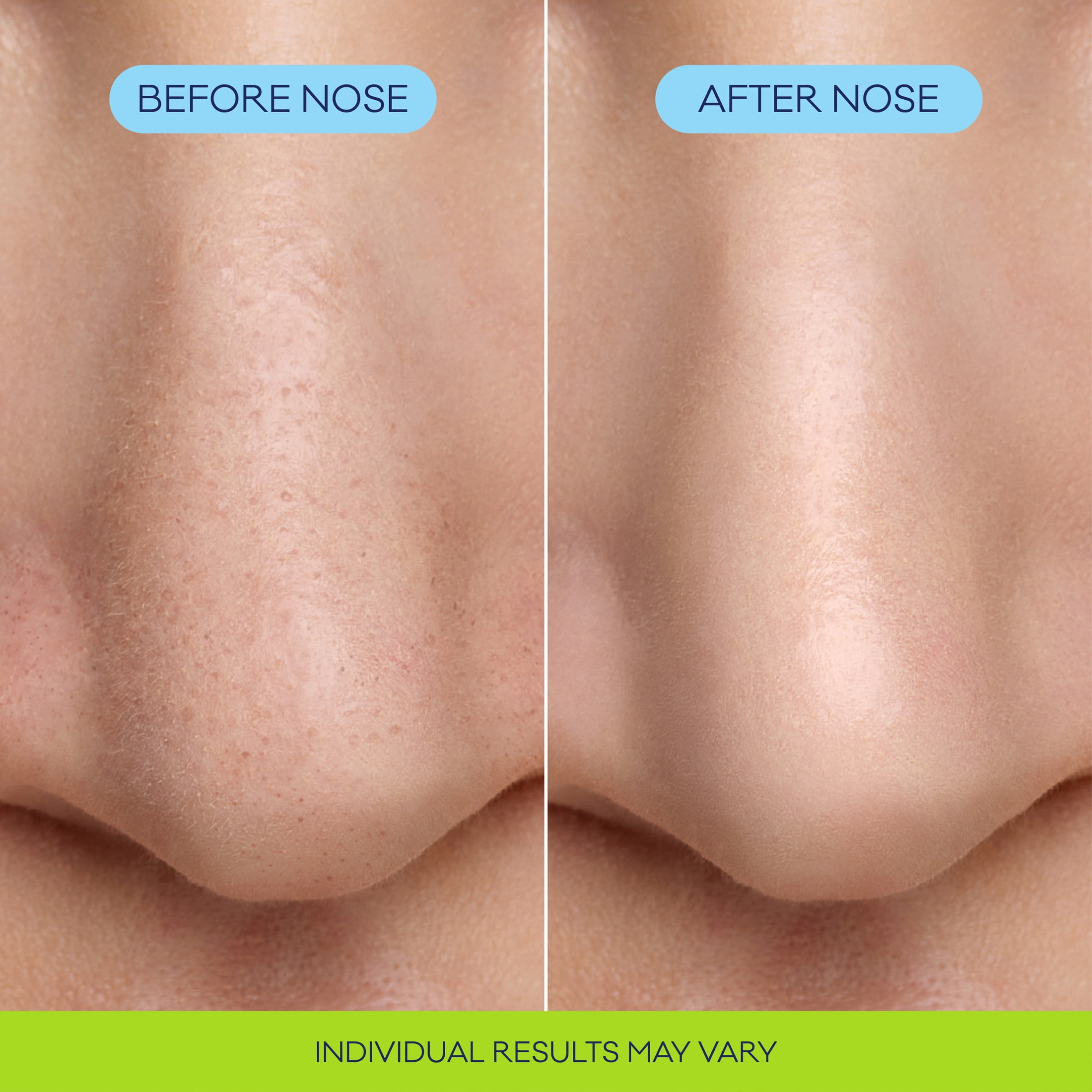Biore Pore Refining Bubbling Nose Mask, Exfoliant for Face, Pore Cleansing Mask, 8 Count