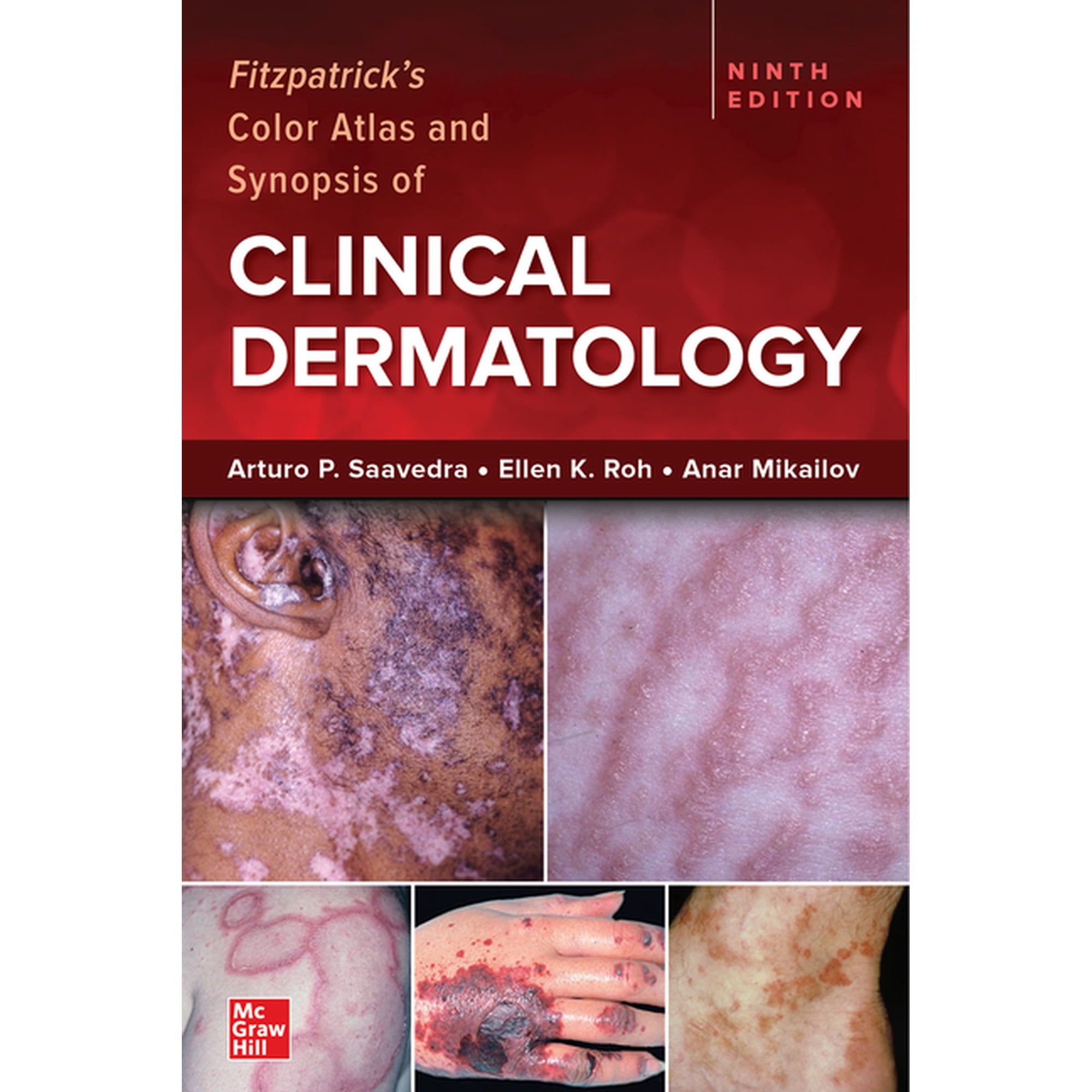 Fitzpatrick's Color Atlas and Synopsis of Clinical Dermatology, Ninth Edition, (Paperback)
