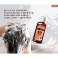thumbnail image 3 of Shampoo de Alquitrán Botica de la trinidad 250ml sin Sulfatos y Parabenos, 3 of 6