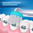 thumbnail image 4 of Cabezal de repuesto para cepillo de dientes eléctrico Oral-B Ortho, 1 unidad, 4 of 9