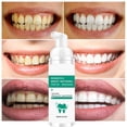 thumbnail image 3 of Blanqueamiento dental Xihbxyly Eliminación de manchas dentales Potenciador del blanqueamiento 60 ml, 3 of 7