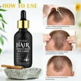 Hair Growth Oil Contains Safflower, Ginseng Extract, Biotin Hair Growth