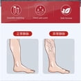 thumbnail image 2 of Lot de 12 patchs pour la santé des veines, pour le traitement des varices des jambes et pour améliorer la circulation, 2 of 4