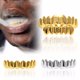 thumbnail image 2 of 2 Piezas Chapado en Oro Brillante Inferior Tapa Halloween Cosplay Joyería Plata Tono Dorado Yuyangstore Gorra con dientes de oro de 18k de Hip Hop, 2 of 8