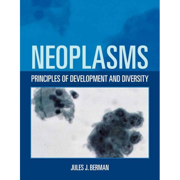 Pre-Owned Neoplasms: Principles of Development and Diversity: Principles of Development and Diversity (Paperback) 0763755702 9780763755706