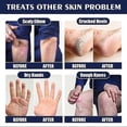thumbnail image 4 of Anti-crack Hand Care Cream Dry Cracked Hands Moisturizing Not-greasy Care Hand Lotion Winter Repair Nourishing Hand Cream, 4 of 5