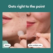 Hero Cosmetics Mighty Patch Micropoint for Blemishes, Early-Stage Blemish Patch, 8 Count