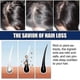 thumbnail image 3 of 1-3X New Alopecia Treatment Cream Hair Growing Prevent Alopecia Baldness Regrowth 20g, 3 of 5
