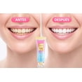 thumbnail image 3 of Pasta Dental Blanqueadora UTOGRU 100 g Remueve Manchas Cuida Esmalte y Refresca Aliento, 3 of 4