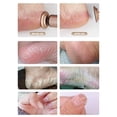 thumbnail image 4 of 2-in-1 Electric Foot Callus Remover, USB Rechargeable with 3 Modes, 3 Size Sanding Discs & Cylinder, Battery Display, Cordless Aluminum Foot/Nail/Dead Skin Tool, Rose Gold., 4 of 9