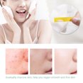 thumbnail image 4 of Facial cleanser acne treatment facial cleanser blackhead removal cleanser deep cleaning facial cleanser oil control face cleanser BREYLEE 100g Acne Treatment Facial Cleanser Deep ANGGREK Otros, 4 of 8