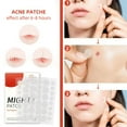 thumbnail image 5 of Zit Stickers Reveal A Cleaner Clearer Nose With Our Grade Blackhead Remover Strips A Must Have For Your Routine., 5 of 5