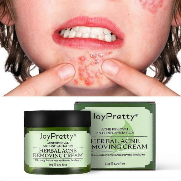 Joypretty Tea Tree Cream Fades Print Cream