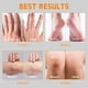 thumbnail image 4 of Crema YOUNGYOUNGLOVE 60% urea con 2% de ácido salicílico 200 ml, 4 of 6