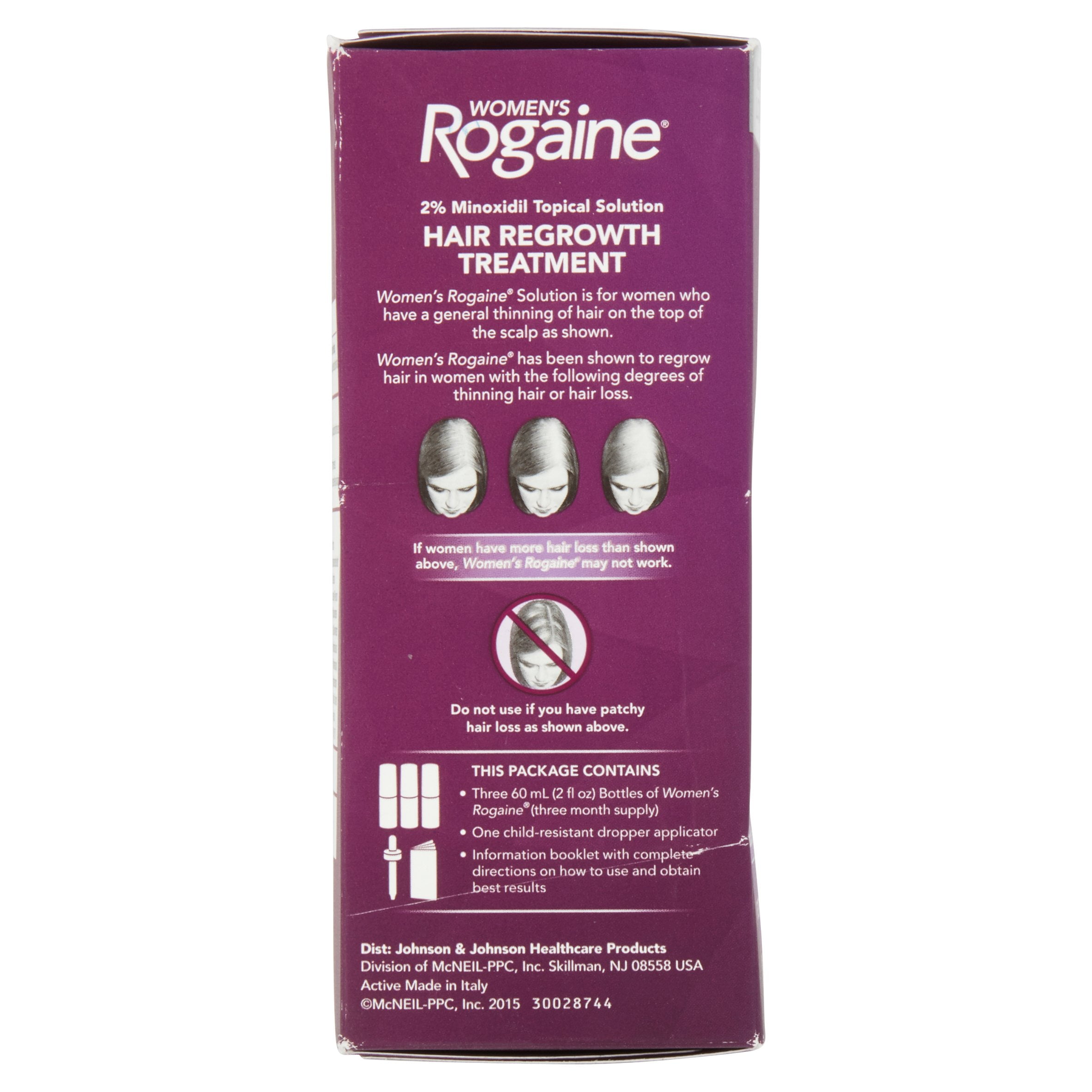 Where is Rogaine effective at growing hair?