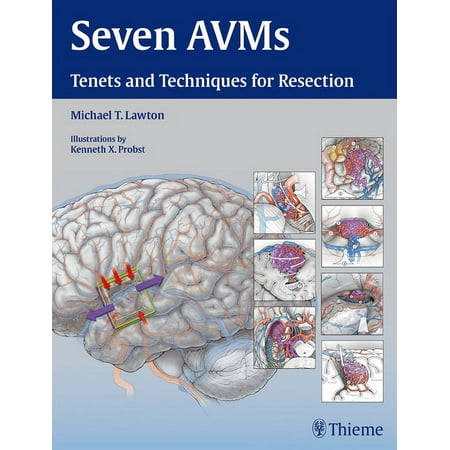 UPC: 9781604068757 | Seven Avms: Tenets and Techniques for Resection (Hardcover)