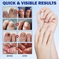 thumbnail image 5 of Fungal Nail Patches, Fungal Nail Treatment 21Pcs, Nails Repair Patches,Nails Fungus Treatment for Toenail,ToeNail Fungal Treatment for Toenails Extra, 5 of 5