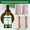 thumbnail image 5 of Cyperus Rotundus Oil, Cyprus Oil Natural Nut Grass Oil for Reducing Body Hair Growth, Smooth Skin and Hair Removal, Moisturizing & Soothing, Ideal for All Skin Types, 5 of 7