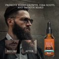 thumbnail image 3 of Set de aceites para barba Jeosisy, paquete de 3, acondicionadores e hidratantes para hombres, 3 of 8