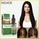 thumbnail image 3 of Eelhoe Rosemary Hair Growth Essential Oil Anti Hair Loss Fast Regrowth Essence Aromatherapy Repair Damaged Frizzy Thinning Scalp Hair-restorer Dense H, 3 of 5
