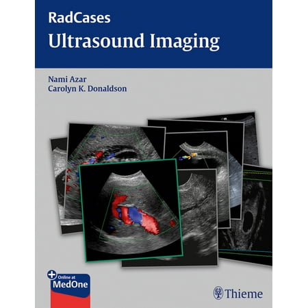 UPC: 9781604063226 | Radcases Plus Q&A: Radcases Ultrasound Imaging (Paperback)