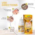 thumbnail image 4 of Nail Fungus Treatment,Sumifun Jiagou Kang Dropping Liquid Trade Gray Nail White Nail, 4 of 5