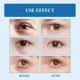thumbnail image 5 of Crema reparadora de péptidos de Venom de serpiente, crema para los ojos, levantamiento, estiramiento, reafirmante, eliminación de edemas, antiarrugas, aclara las líneas finas, ilumina el original, 5 of 5
