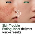 thumbnail image 3 of Crema reparadora IVOSKIN Intensive Cica con Madecassoside 50g, 3 of 6