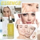 thumbnail image 4 of Essence Oils For Candles Essential oils Facial Skin Barrier Relief Sensitive Skin Rejuvenation Firming Moisturizing 30ML Oil(buy 2 get 10% off), 4 of 5