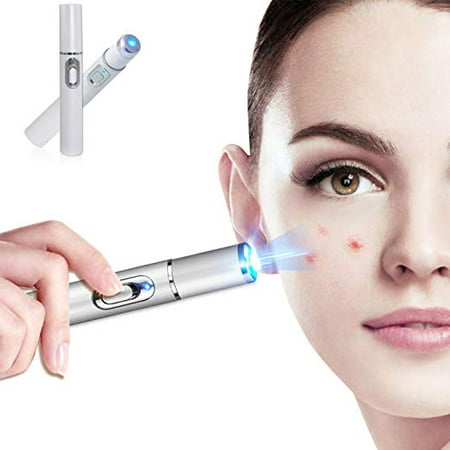 Portable Anti-varicose Veins Face Acne Removal Pen Blue Light Machine Scar Blemishes Pimples Removal Therapy (Best Thing To Use For Acne Scars)