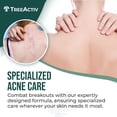 thumbnail image 2 of Spray para tratamiento del acné corporal TreeActiv, 120 ml, 2% de ácido salicílico, 2 of 7