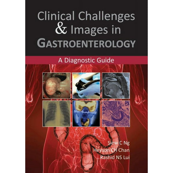 Clinical Challenges & Images in Gastroenterology: A Diagnostic Guide (Paperback)