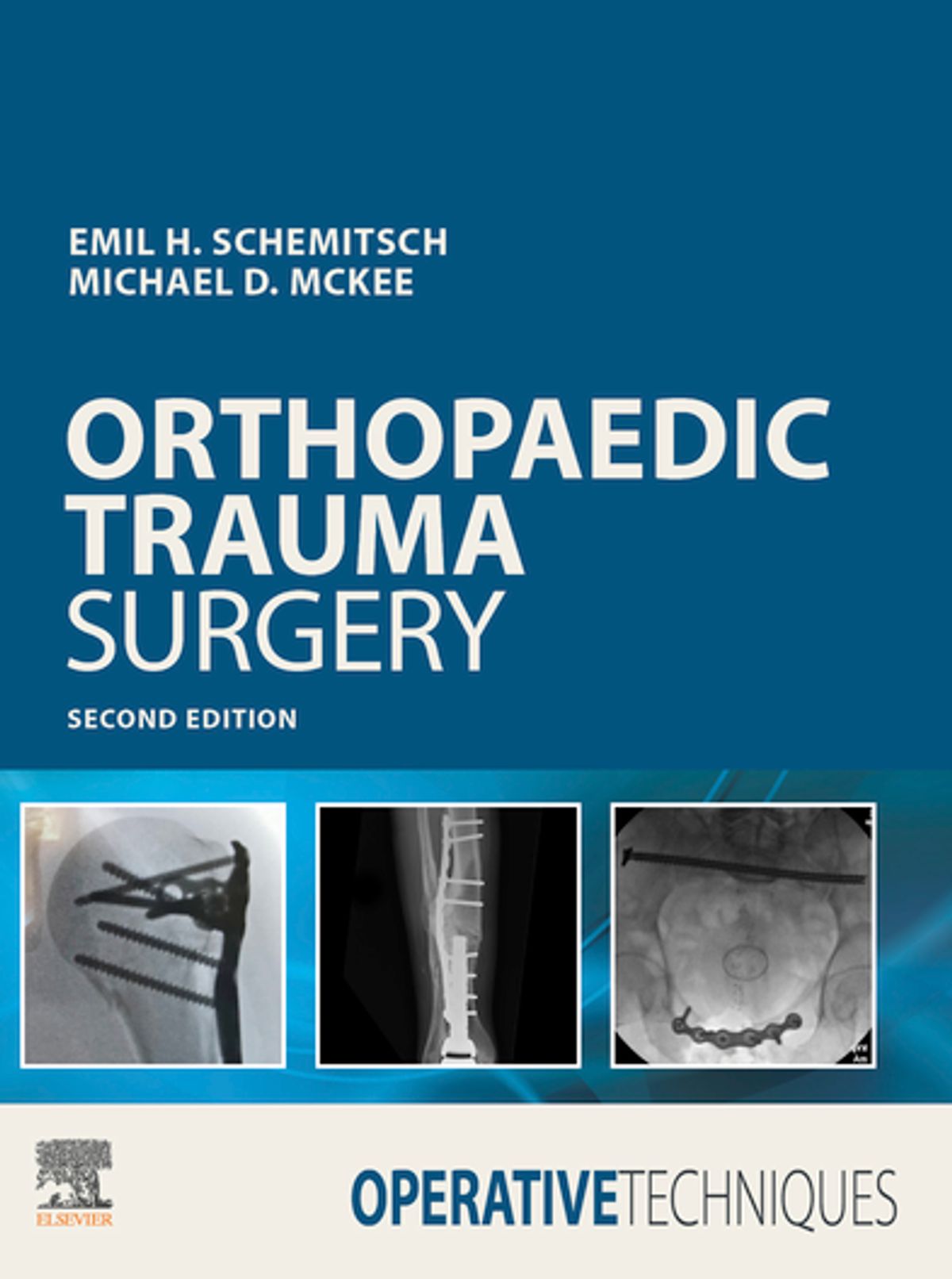 Operative Techniques Orthopaedic Trauma Surgery EBook eBook