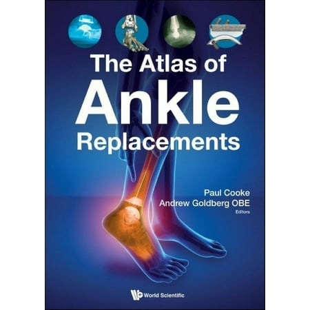 UPC: 9781786349712 | The Atlas of Ankle Replacements (Paperback)