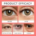 thumbnail image 6 of Lifting & Firming Eye Gel 20g, Depuffing Gel for Dark Circles, Hydrating, Cool-Touch Application, 6 of 9