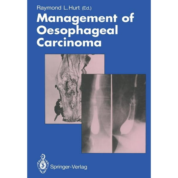 Management of Oesophageal Carcinoma, (Paperback)