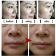 thumbnail image 3 of Face Cream Anti Aging Wrinkle Removal Moisturizing Six Peptide Cream 30ml, 3 of 4