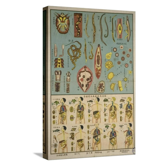 Art.com Parasites in the Human Body Stretched Canvas Print Wall Art, 12" x 18"