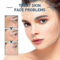 thumbnail image 2 of 3pcs Anti-ageing Hyalu B5 Serum Anti-wrinkle Concentrate Repairing 30ml, 2 of 5