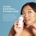 thumbnail image 4 of Jan Marini Skin Research Benzoyl Peroxide Acne Treatment Lotion 5% - 4 Fl Oz, 4 of 8