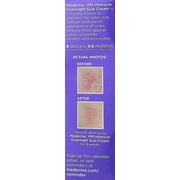 Mederma PM Intensive Overnight Scar Cream