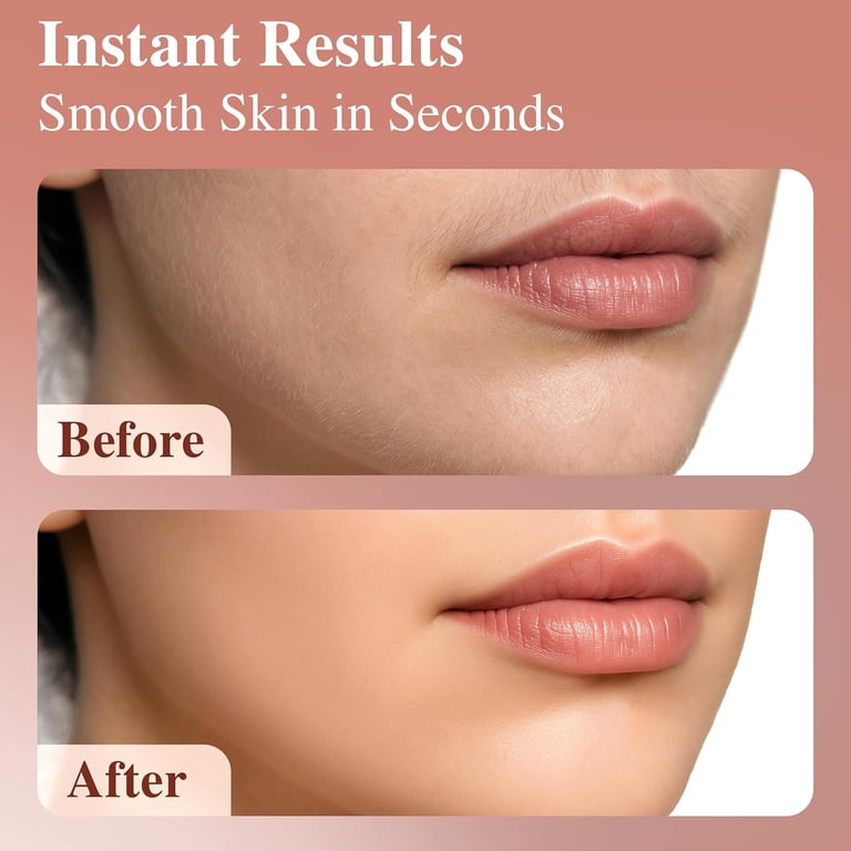 YOOVEE Rechargeable LED Facial Hair Remover for Women photo 2