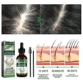 thumbnail image 2 of Rosemary Oil For Hair Growth, Rosemary Essential Oil For Hair Loss Regrowth Treatment,for Nails &cuticles,nourish Scalp,dry Skin Relief zhangyuxiang LED, 2 of 2