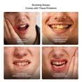 thumbnail image 3 of Cepillo de dientes ZDEER de cerdas ultrasuaves con 6 cabezales reemplazables, 3 of 9