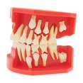 thumbnail image 2 of Dentalmall Teeth Typodonts Dental Model #7013 - Teeth Eruption Development Model Alternating Model Of Constant Pressure Of Deciduous Teeth, 2 of 4