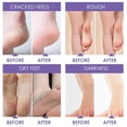 thumbnail image 3 of Upgraded 2026 Peeling Foot Mask Exfoliating Foot Mask Socks Baby Feet Mask 1 Pair 38ml, 3 of 6